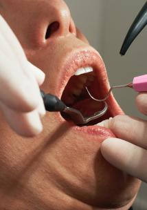 Dental treatment Patient receiving dental treatment